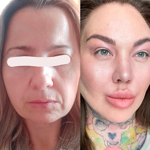 [Ярослава Науменко] Антиэйдж в большом городе (202_0.png